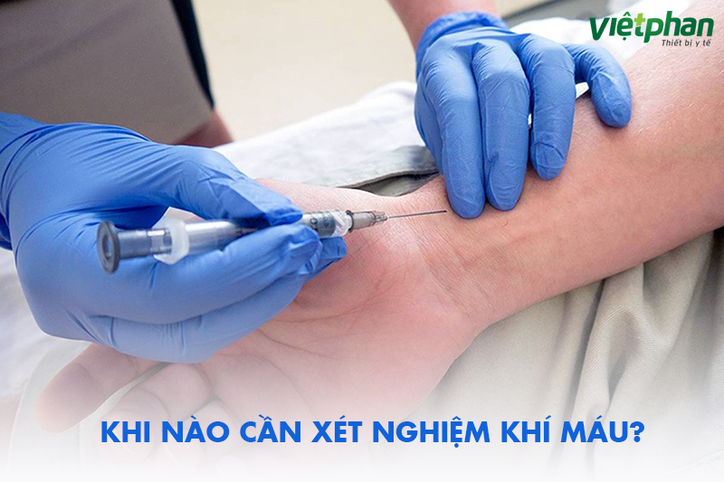 Khi nào cần xét nghiệm khí máu 