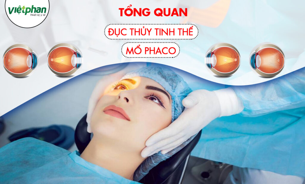 TỔNG QUAN VỀ BỆNH ĐỤC THỦY TINH THỂ VÀ PHƯƠNG PHÁP MỔ PHACO