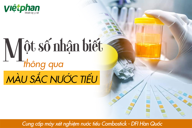 CÓ THỂ NHẬN BIẾT ĐƯỢC ĐIỀU GÌ THÔNG QUA MÀU SẮC NƯỚC TIỂU?