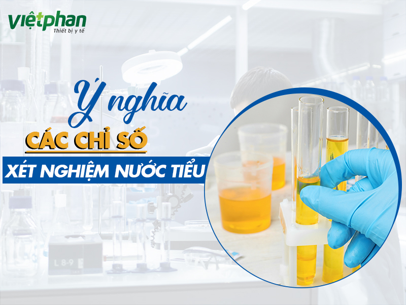 Ý nghĩa các chỉ số xét nghiệm nước tiểu